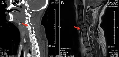 Computerized tomography
