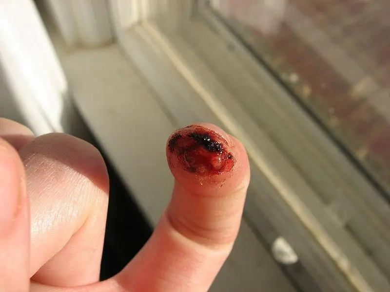 Cut Finger