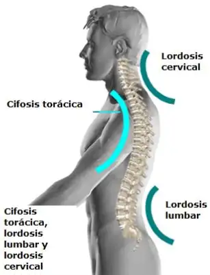 lordosis and kyphosis
