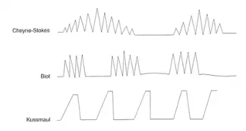 respiration patterns