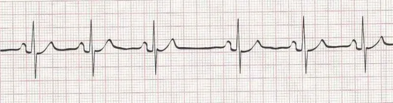ECG requirements
