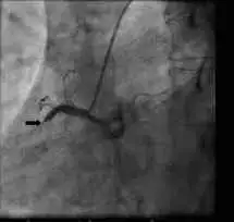 Patient’s cardiac catheterization