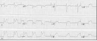Running KVO at the time of report